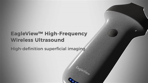 EagleView High-Frequency Linear Ultrasound Scanner
