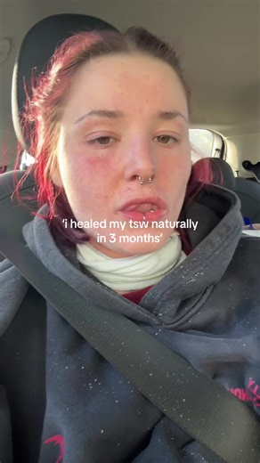 Natural Healing of Topical Steroid Withdrawal