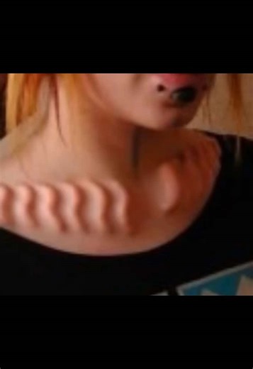 subdermal implants #bodyimplant #bodymods #implants #modifications