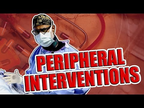 Cardiovascular Interventions Orlando - Peripheral Interventions