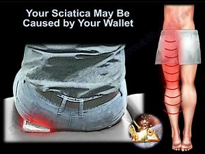 Your Sciatica May Be Caused By Your Wallet - Everything You Need To Know - Dr. Nabil Ebraheim