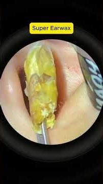 Ear Cleaning