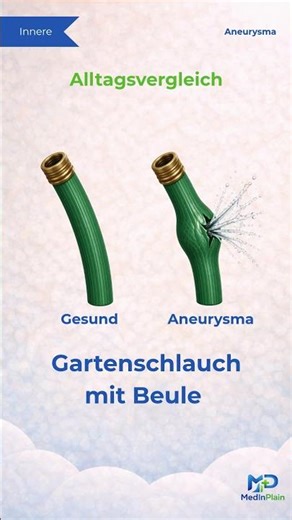 Was ist ein Aneurysma? Einfach erklärt 🫀