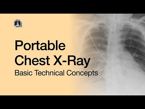 Portable Chest X-Ray: Basic Technical Concepts