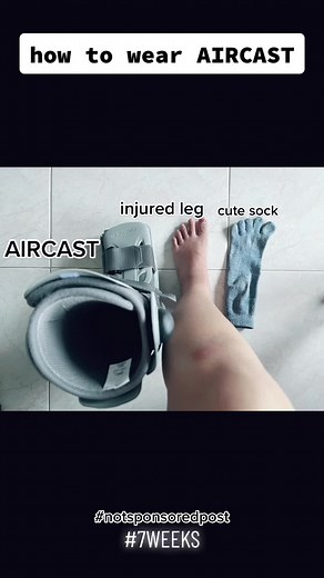 How to Walk with Air Cast: A Comprehensive Guide