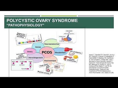 PCOS lecture