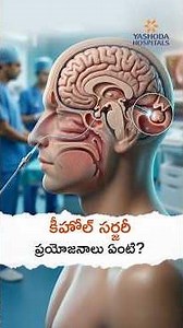 What are the Benefits of Keyhole Surgery in Neurosurgery? | Dr. K. S. Kiran