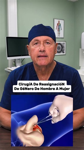 Cirugía de Hombre a Mujer: Información y Consejos de Salud