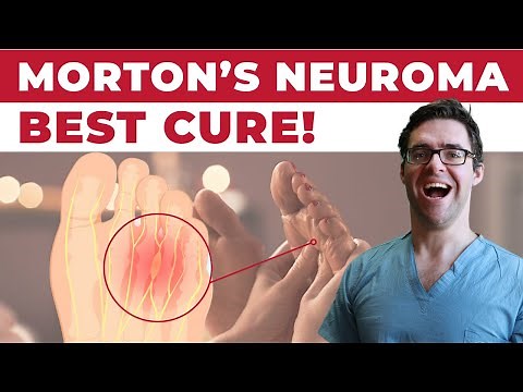 11 BEST Mortons Neuroma Massage, Exercise & Stretch Treatments [WOW!]