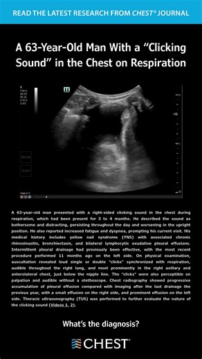 A 63-Year-Old Man With a “Clicking Sound” in the Chest on Respiration What's the diagnosis? Read the full article in the December issue of the journal CHEST®: https://hubs.la/Q03Z4_f-0 #MedEd #JournalCHEST | American College of Chest Physicians