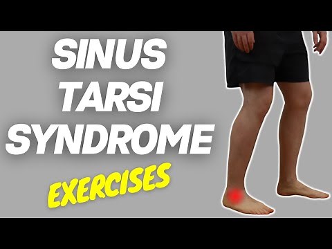 How to treat Sinus Tarsi Syndrome | Best exercises for Sinus Tarsi Syndrome