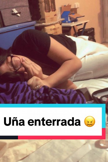 Cómo prevenir uñas enterradas: consejos y cuidados