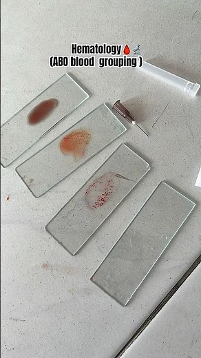 ABO blood grouping- Physiology Practical- Blood typing/ Blood Groupingstep by step #ytshorts#neet