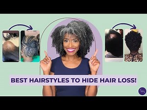 The BEST Hairstyles for Severe Thinning, Balding & Hair Loss