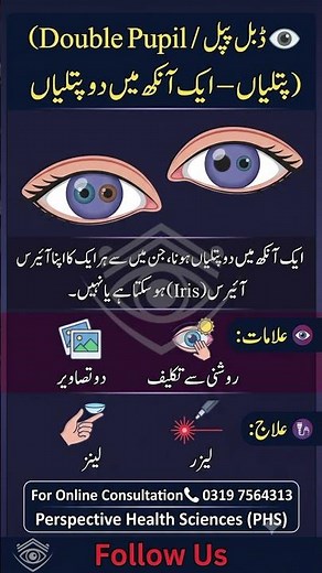Double Pupil (Polycoria) | Rare Eye Condition |
