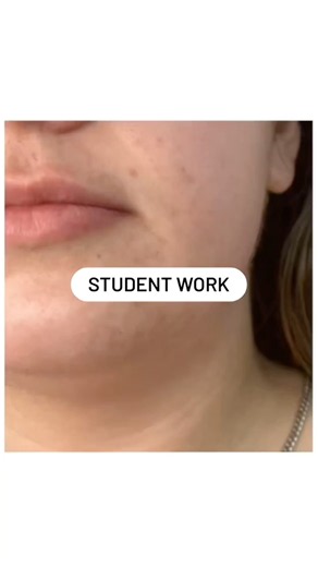 Body Sculpting Before and After | Double Chin Reduction #bodycontouringtraining #bodysculpting
