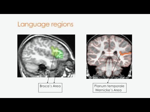 On the Origins and Development of Language and Communication in Autism Spectrum Disorder