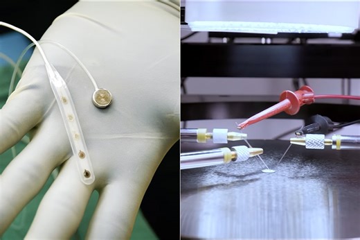 Neuralink Rival Paradromics Successfully Implants Connexus Brain-Computer Interface (BCI) in Epilepsy Patient for the First Time