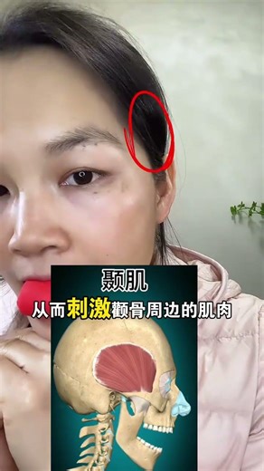 How to Fix Sunken Temples and High Cheekbones