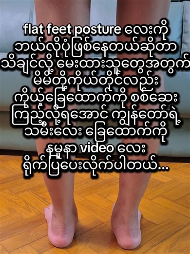 မေးမြန်းထားကြတဲ့အတိုင်း သမီးလေးလို့ ဖြစ်သလို အလားတူ flat feet ဖြစ်နေသူတွေအတွက် လေ့လာလို့ ရအောင် knowledge sharing လုပ်ပေးတာပါ..လေ့ကျင့်ခန်းတွေလည်း ထက်တင်ပေးမှာဖြစ်ပါတယ်...video တွေက ဘာမှ ရောင်းချတာ မဟုတ်သလို..အကျိုးအမြတ်အတွက် ဘာမှ ကြေငြာပေးတာလည်း မရှိပါဘူး..blame ချင်သူများ blame စရာ မဆိုင်တာ ရှာဖွေတွေ့ရင် အားမနာတန်း cb မှာလည်း လာပြောလို့ရပါတယ်...🫡😅💪 #mydaughter_myprincess #mydaughterismyworld #mydaughter #kidstraining #trending
