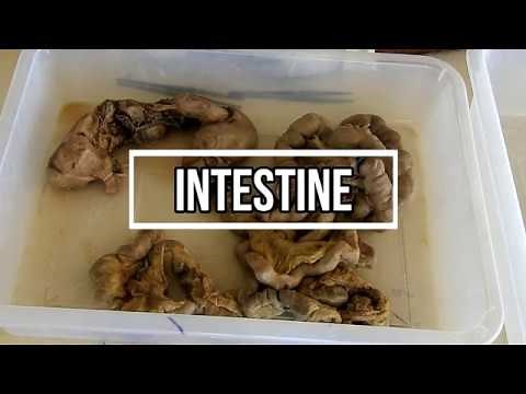 Intestines - small and large gross anatomy