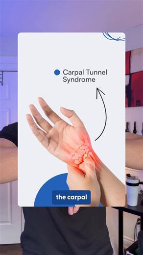 BELIEF BAY on Instagram: "🖐️ Phalen’s Test A common clinical screening tool used to check symptoms related to the median nerve at the wrist. Holding the wrists in flexion may increase pressure in the carpal tunnel, which can cause tingling, numbness, or discomfort in the thumb, index, or middle fingers. ⚠️ This test does NOT diagnose carpal tunnel syndrome. Only a regulated health professional can assess and diagnose. My self Harinder Singh OTA/PTA | Rehabilitation Assistant 📚 For educational 