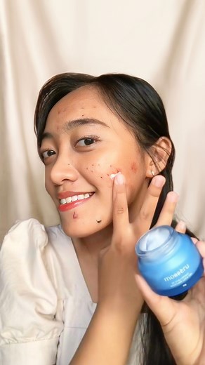 Mossèru Official on Instagram: "Honest review by @merrybejo ✨ PR paling susahnya temen-temen yang Acne Prone Skin tuh emang bekasnya sih! Tapi semuanya bisa diatasin pake Bright Serum kok 😍 ✅ 3% Tranexamic Acid : 9x lebih cepet pudarin bekas jerawat daripada Vitamin C *9 jenis Antioxidants (Triethanolamine, Allantoin, Alpha Arbutin, Licorice Root Extract, Portulaca Oleracea Flower Extract, Paeonia Suffriticosa, Root Bark Extract, Paeonia Lactifiora Extract, Grape Seed Extract, Lycium Chinense F
