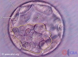 When Does a Fetus Have a Heartbeat? | Human Life International