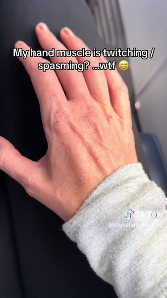 I have no idea what this is or why it’s happening 😵‍💫