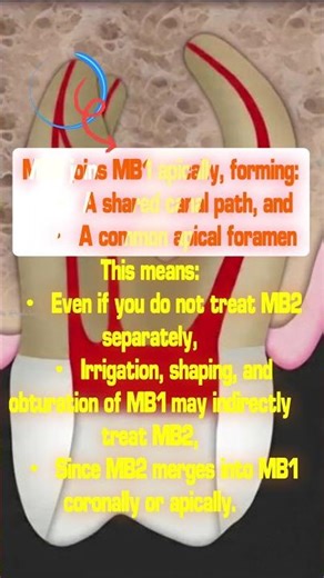 Why Do Clinicians Sometimes Miss MB2? | Dr.Dentique-hub