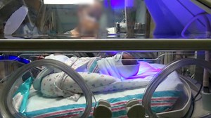 Growing number of infants infected with syphilis