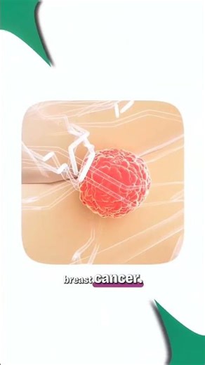 A Painless Lump Could Be Breast Cancer — Don’t Ignore This Sign