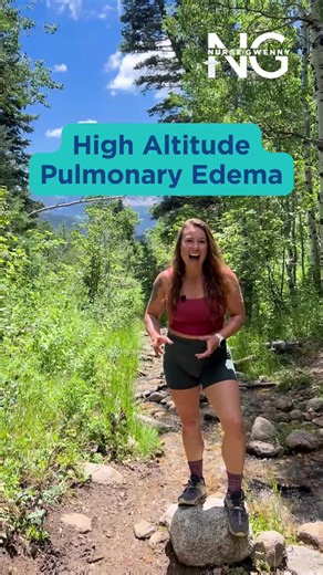 High Altitude Pulmonary Edema (HAPE) Causes, Signs, Treatment
