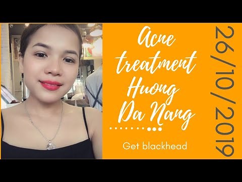 (Sub) Get blackhead | 26/10/2019 | Acne treatment Hương Đà Nẵng