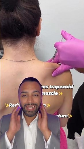 Barbie BOTOX?! Aka Trap Tox | Dr Somji Explains