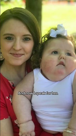 Shaken baby syndrome changed everything 💔