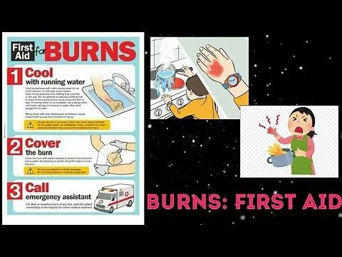 BURNS: FIRST AID | Burn management | how to help a burn patient.