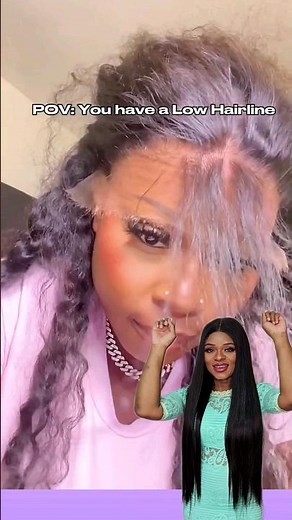 How To Fix Your Low Hairline For Wigs