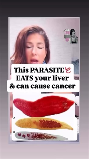 21 reactions · 14 comments | 缾HOW TO GET RID OF the COMMON LIVER...