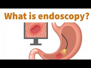 What is endoscopy ? @Alearninglane