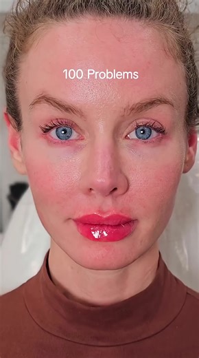 ✨ The Aesthetics Therapy – Your Secret to Timeless Beauty in London ✨ Discover the Magic: 💉 Anti-Wrinkle Injections – Smooth lines, keep your glow 💋 Dermal Fillers – Plump lips, sculpt cheeks, define jawlines & tear troughs 🧵 PDO Thread Lifts – Instant lift for face, neck & body (no knives, no scars) 🔥 Fat-Dissolving Injections – Melt stubborn pockets, reveal your contours 🌊 Polynucleotides & Skin Boosters – Hydrate, heal, regenerate from within 👃 Non-Surgical Rhinoplasty – Refine your pro