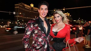 Woman who had ribs removed to look like Jessica Rabbit warned she needs corset to stay alive