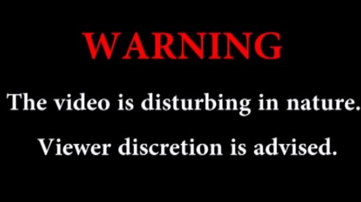 Caught on camera: Man accidentally shoots himself in head