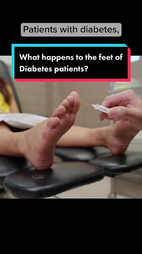 Diabetes and Foot Health: Understanding Symptoms and Care