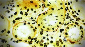 DANGEROUS BACTERIA THAT CAN STRIKE HUMANS AND DOGS "All it takes is one blade of grass and one drop of urine,"doctors say. http://cbsloc.al/2sskNyk | CBS Philadelphia