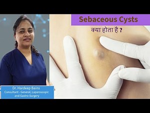 Sebaceous Cyst Removal | Surgery of Sebaceous Cyst By Dr. Hardeep Bains in Delhi