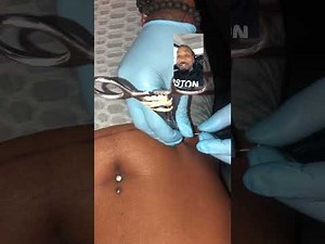 Surface Hip Piercing