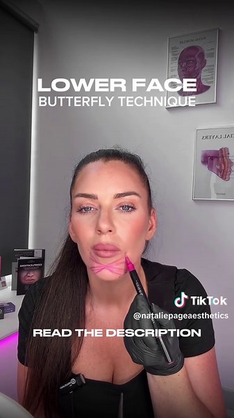 Butterfly Technique for Lower Face Contouring