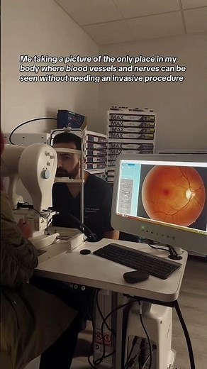 I’m capturing detailed images of my own retinas using our new OCT and retinal fundus camera
