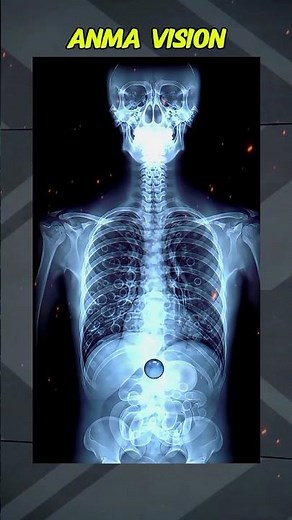 What Happens If You Swallow a Marble? | Shocking Medical Fact #storytelling #facts #movies